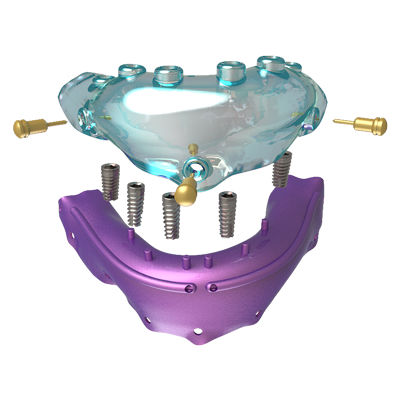 Guía quirúrgica de implantología dental - Osteophoenix