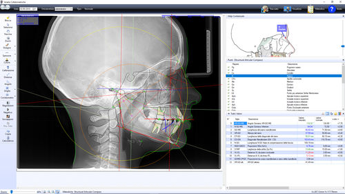 Software para ortodoncia - OrthoTP - Microlab - de análisis