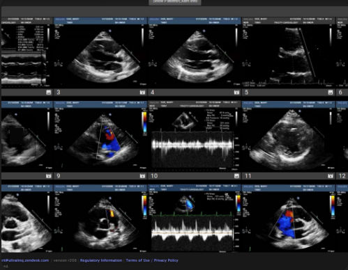 PACS para imágenes médicas - Cardiology - UltraLinq