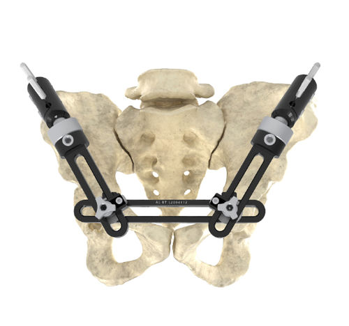 Fijador externo de pelvis - Wuxi Betta Medical Technology - tubular / para adulto