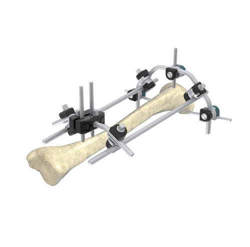 Fijador Externo Para Tibia Wuxi Betta Medical Technology H Brido Para Adulto