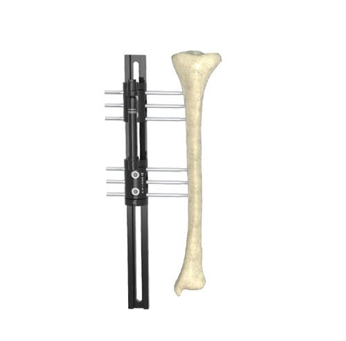 Fijador externo modular - Wuxi Betta Medical Technology - tubular / para adulto