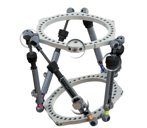 Fijador externo para tibia - Wuxi Betta Medical Technology - para fémur / para tobillo / circular