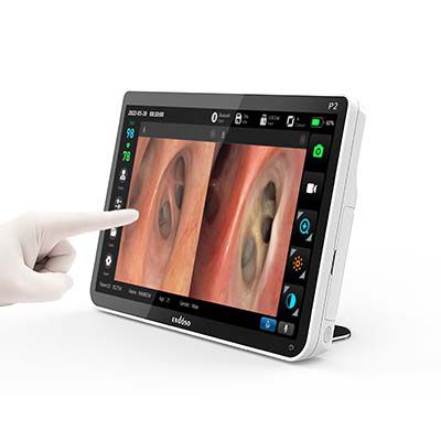 Procesador de vídeo para endoscopia - P1 - Endoso Life Technology - con puerto USB / con monitor de vídeo / con grabadora