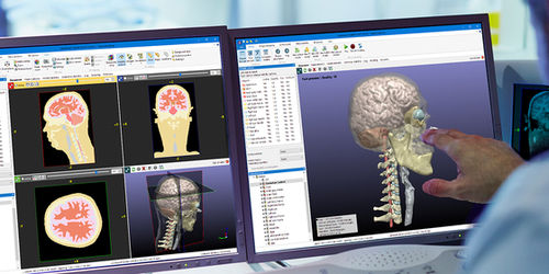 software para imágenes médicas - Synopsys Simpleware Product Group