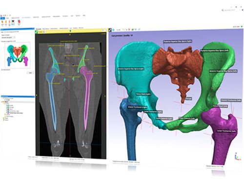 Módulo de software de planificación - Simpleware Automated Solution  - Synopsys Simpleware Product Group - de diseño / de aprendizaje automático / médico