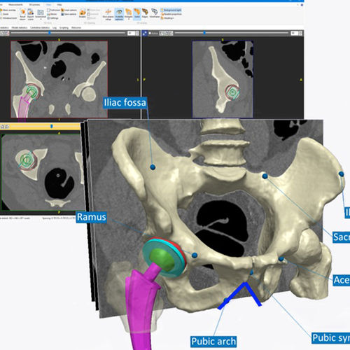 Software clínico - Simpleware ScanIP  - Synopsys Simpleware Product Group - para imágenes médicas / preclínico / preoperatorio
