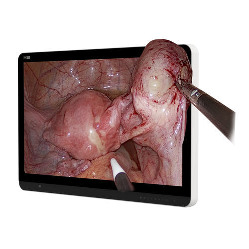 monitor médico - Hikimaging