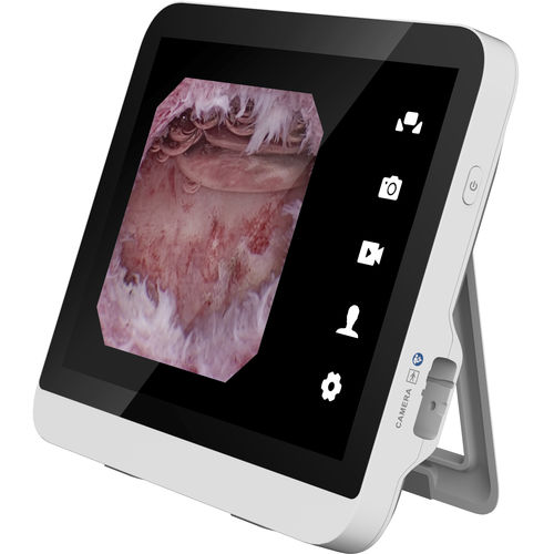Procesador de vídeo para endoscopia - MIK-P2102HMSA3 - Hikimaging - con puerto USB / con monitor de vídeo / para imágenes en HD