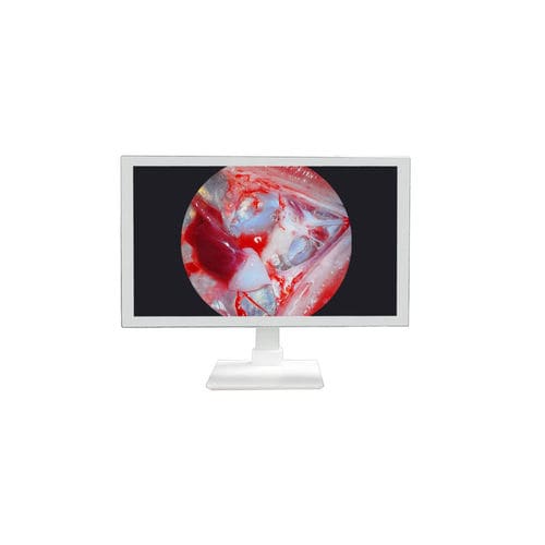 Monitor médico - TU-24M1080P - Shenzhen Tuyou Medical Imaging Co., Ltd.​ - para sala de operaciones / quirúrgico / 27"