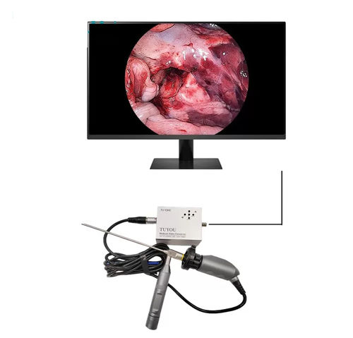 Cámara para endoscopio - TU-Y2HC - Shenzhen Tuyou Medical Imaging Co., Ltd.​ - médica / digital / Full HD