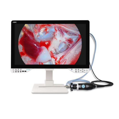 Cámara para endoscopio - TU-27LSD1A - Shenzhen Tuyou Medical Imaging Co., Ltd.​ - médica / digital / de alta definición