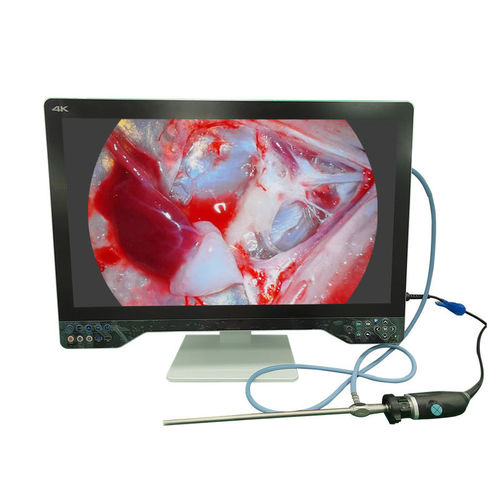 Cámara para endoscopio - TU-32LSD1A - Shenzhen Tuyou Medical Imaging Co., Ltd.​ - médica / quirúrgica / digital