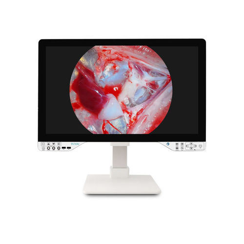 Cámara para endoscopio - TU-27LSD2B - Shenzhen Tuyou Medical Imaging Co., Ltd.​ - digital / VGA / de alta definición