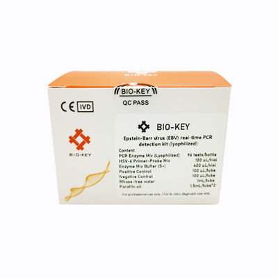 Kit de prueba para enfermermedades infecciosas - BIK-QL-H0017 - Biokey Health - del virus de Epstein-Barr / de suero / por plasma