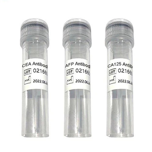 Reactivo de ACE - Ab100501 - Chengdu Vacure Biotechnology Co., Ltd - anticuerpos / antígeno / de diagnóstico