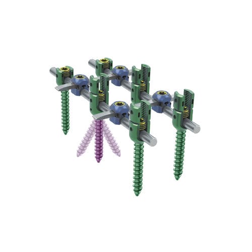 Sistema de osteosíntesis toracolumbar - KSS-I 6.0 - Kangli Medical - vía posterior / para adulto