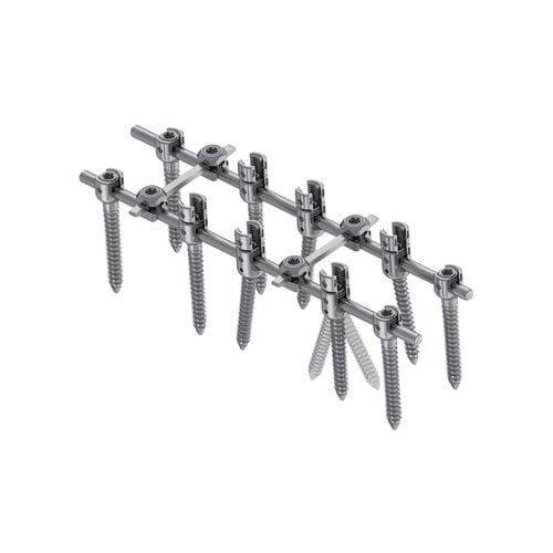 Sistema de osteosíntesis toracolumbar - KSS-II 5.5 - Kangli Medical - vía posterior / para adulto / pediátrico