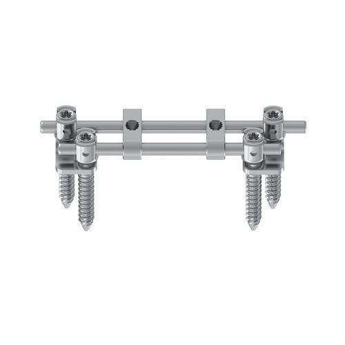 Sistema de osteosíntesis toracolumbar - KSS-II 5.5 - Kangli Medical - vía posterior / para adulto