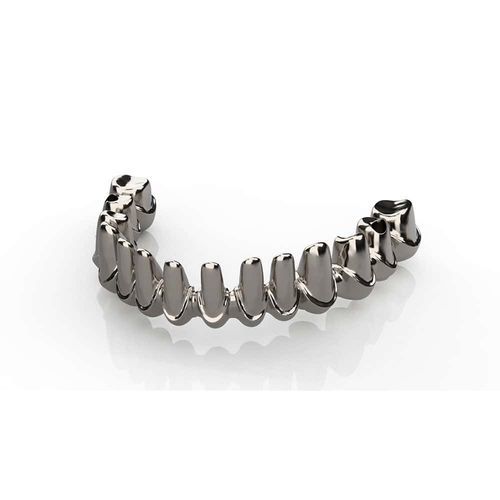 Puente dental de metal - Kangli Medical - de los dientes anteriores