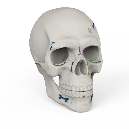 Sistema de fijación craneal no reabsorbible - MCF - Kangli Medical