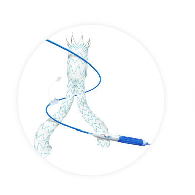 Stent-injerto aorta abdominal - Minos™ - Endovastec - arteria ilíaca / de nitinol / de polietileno