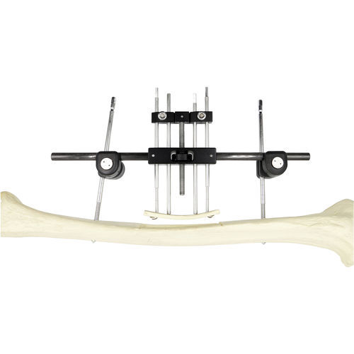 Fijador externo para fémur - Chongqing FWS Medical Device - tubular / para adulto