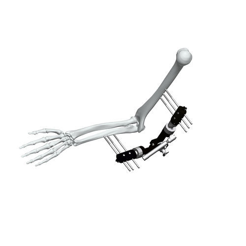 Fijador externo para codo - FE5M-D040 - Chongqing FWS Medical Device - tubular / para adulto
