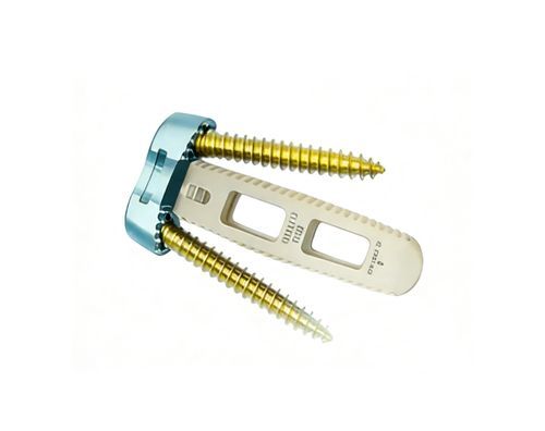 Caja intersomática cervical - O-LIF - Chongqing FWS Medical Device - vía anterior / de PEEK