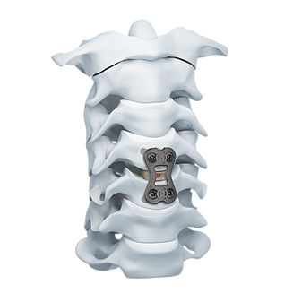 Placa de artrodesis cervical - CAP  - Mediox - 1 nivel