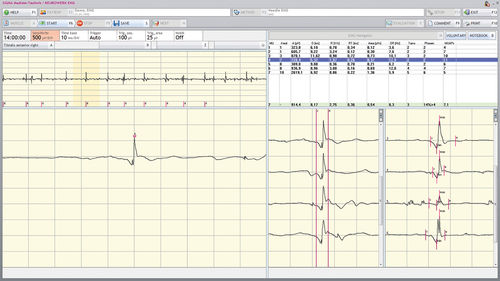 Software de gestión de datos - NEUROWERK® - Natus Micromed - de medición / de evaluación / para EEG