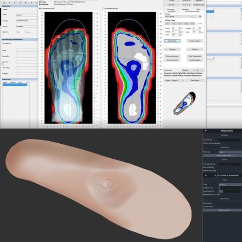 Software de creación de plantillas ortopédicas - OrthoWin - Orthema Service - para podología / de pie / automatizado