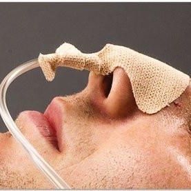 Fijador de catéter sonda nasogástrica - Difanas  - Zadi Tıbbi Gereçler San. ve Tic. A.Ş. - en cabeza / adhesivo