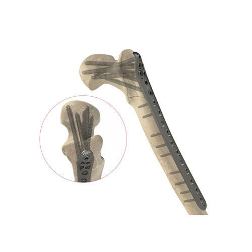 Placa de compresión para fémur - Ases Orthopedics - porción proximal / bloqueada