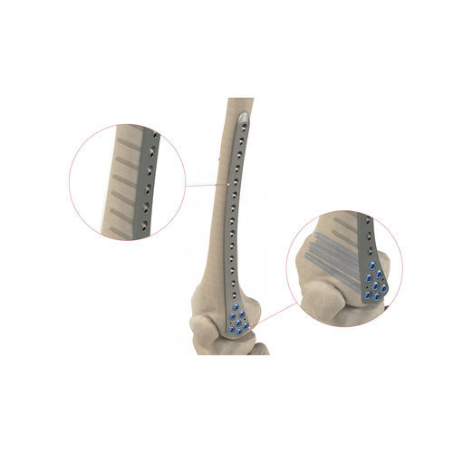 Placa de compresión para cóndilo femoral - Ases Orthopedics - porción distal / bloqueada