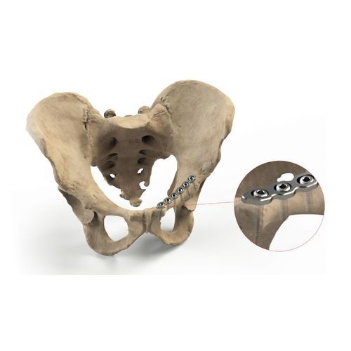 Placa de compresión para pelvis - Ases Orthopedics - bloqueada