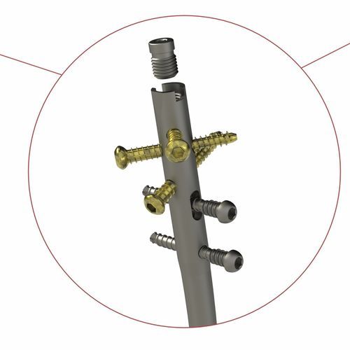 Clavo intramedular para tibia - 4T1-4011000 - Ases Orthopedics