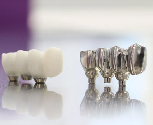 Puente dental de titanio - Copywax - Panthera Dental - CoCr / de fibra acrílica / de circona