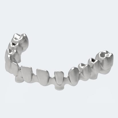 Puente dental de PMMA - NEW ANCORVIS S.r.l - de cerámica / de circona / para dientes posteriores