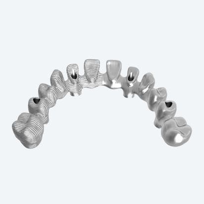 Puente dental de titanio - NEW ANCORVIS S.r.l - para dientes posteriores