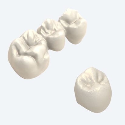 Prótesis dental de PMMA - NEW ANCORVIS S.r.l - de composite / de circona / CoCr