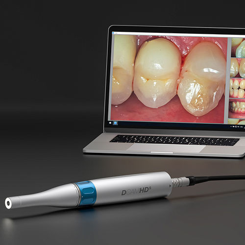 Cámara intraoral - D-CAM HDS - I.C. LERCHER - analógica / HD / 2560 x 1920
