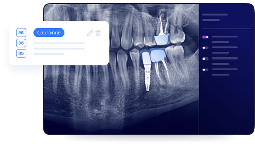 Software de implantología dental - Allisone - Allisone Technologies - para cirugía dental / de radiografía / de visualización