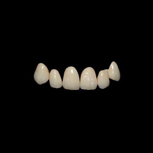 Corona dental de circona - Shenzhen Alcadent Co.Ltd Alcadent Dental Laboratory - incisivos superiores / para dientes posteriores