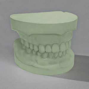 Material dental de piedra - Glastone® 3000 die - Ransom & Randolph - para puente dental / para corona