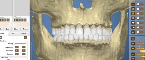 Software para odontología - OrthoAnalysis - Inteware Co., Ltd - de análisis / de tratamiento / de planificación de tratamiento