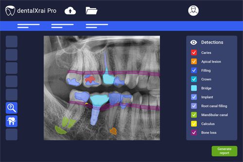 Software de análisis - dentalXrai Pro 3.0 - dentalXrai GmbH - de evaluación / médico / para odontología