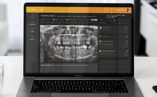 Plataforma de IA para imágenes médicas - Second Dentist ™ - VELMENI - para el sector médico / para odontología / de análisis