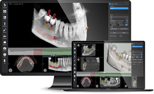 Software de diseño - Implant 3D - MediaLab - de simulación en 3D / de filmación de inspección / médico