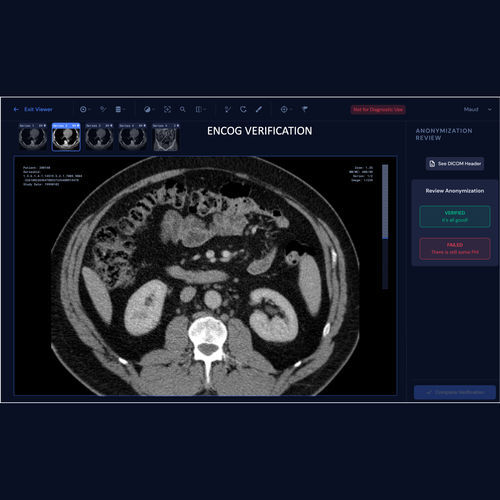 Aplicación web de gestión de datos - ENCOG™ - Enlitic - de trazabilidad de los datos / médica / TDM